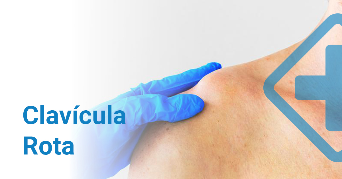 Clavícula Rota